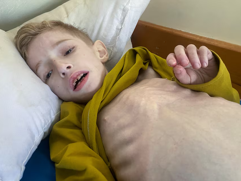 Gaza: Starving children fill hospital wards as famine looms