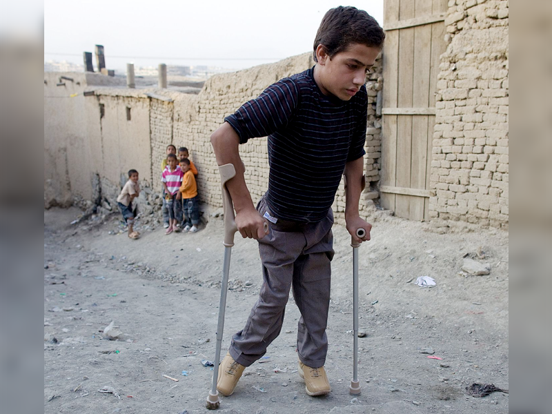 First polio case of 2023 reported in KP First polio case of 2023 reported in KP